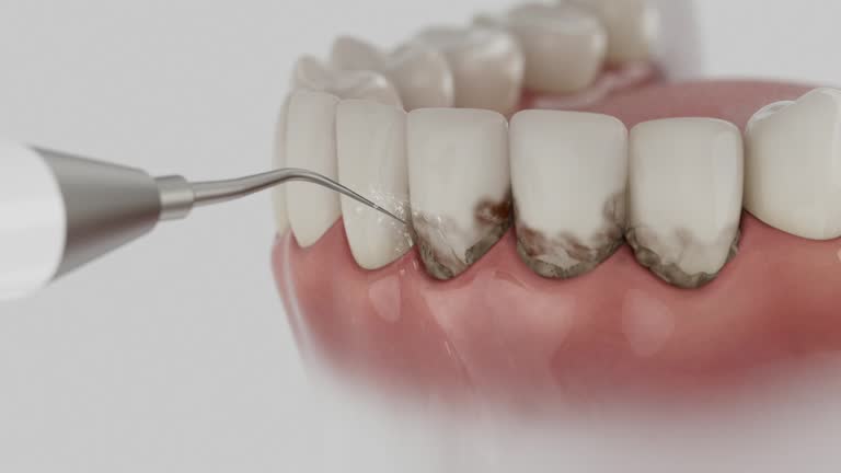Reliable Dental Implants contractor in Arkoma, OK by Smile Center Dentistry